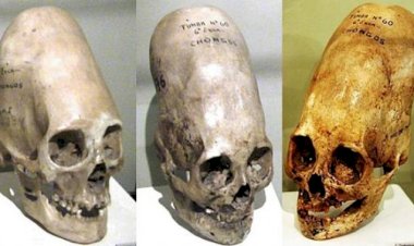 Misterul craniilor alungite – Moștenirea genetică a unei rase necunoscute