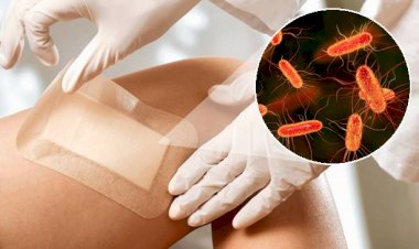 Pansamentul inteligent: detectează și tratează automat infecțiile bacteriene