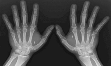 Australia devine prima ţară ce demarează micro-ciparea propriilor cetăţeni